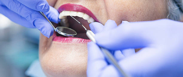 Best Emergency Cosmetic Dentistry (e.g., broken veneers) in Pleasanton, CA